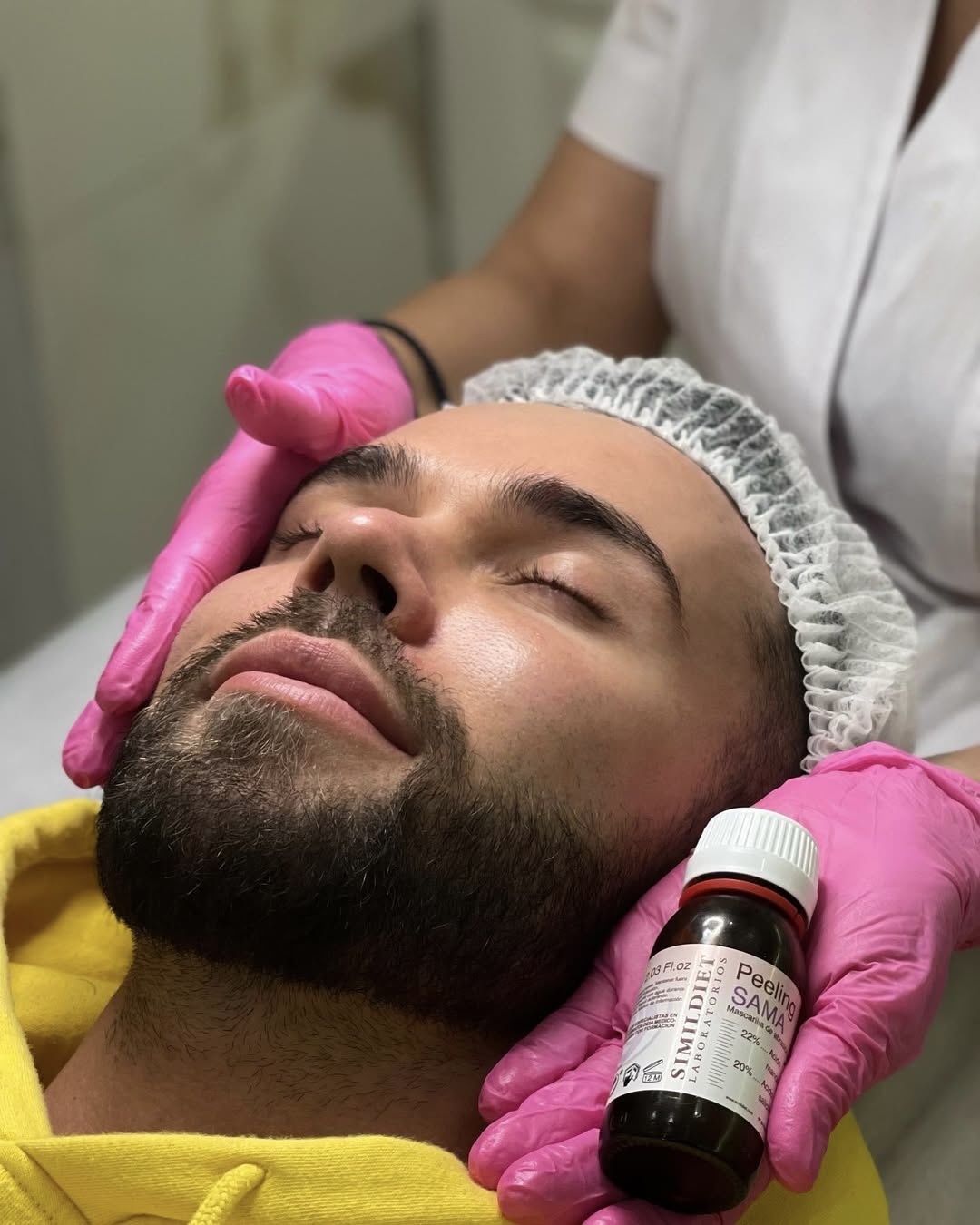 Trattamento facial e peeling